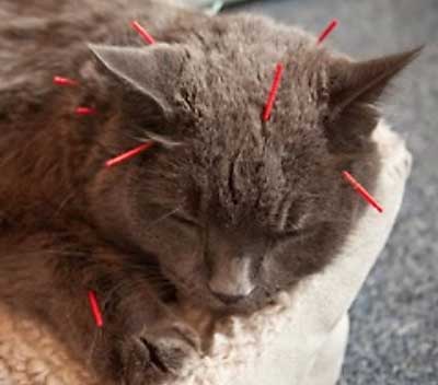 Acupuncture